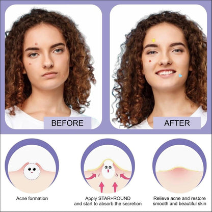 Derma Dots - Value Pack (180 Pcs)