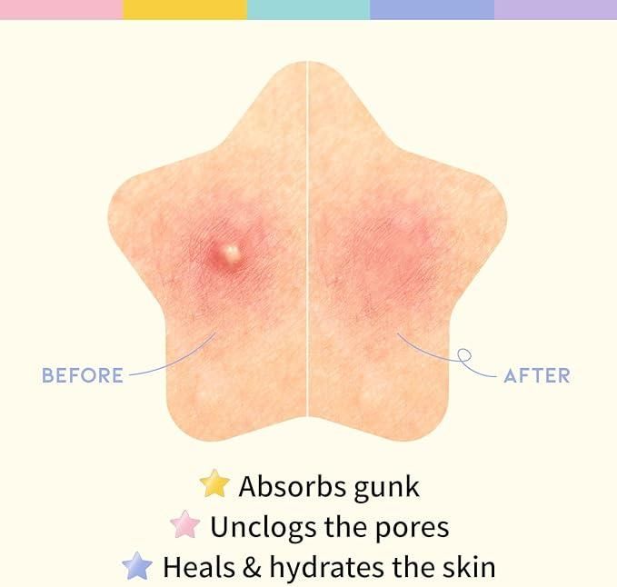 Derma Dots - Value Pack (180 Pcs)